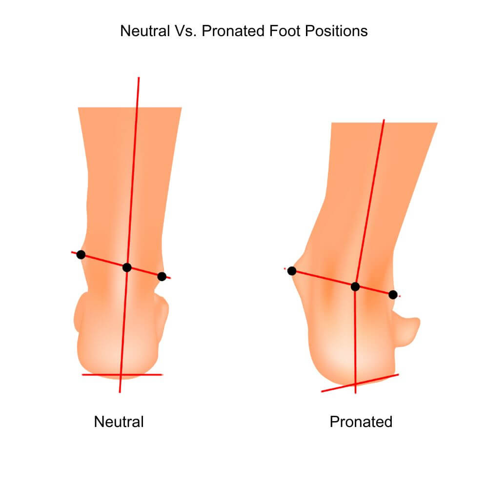 Neutral Foot Position Vs. Pronated Foot Position