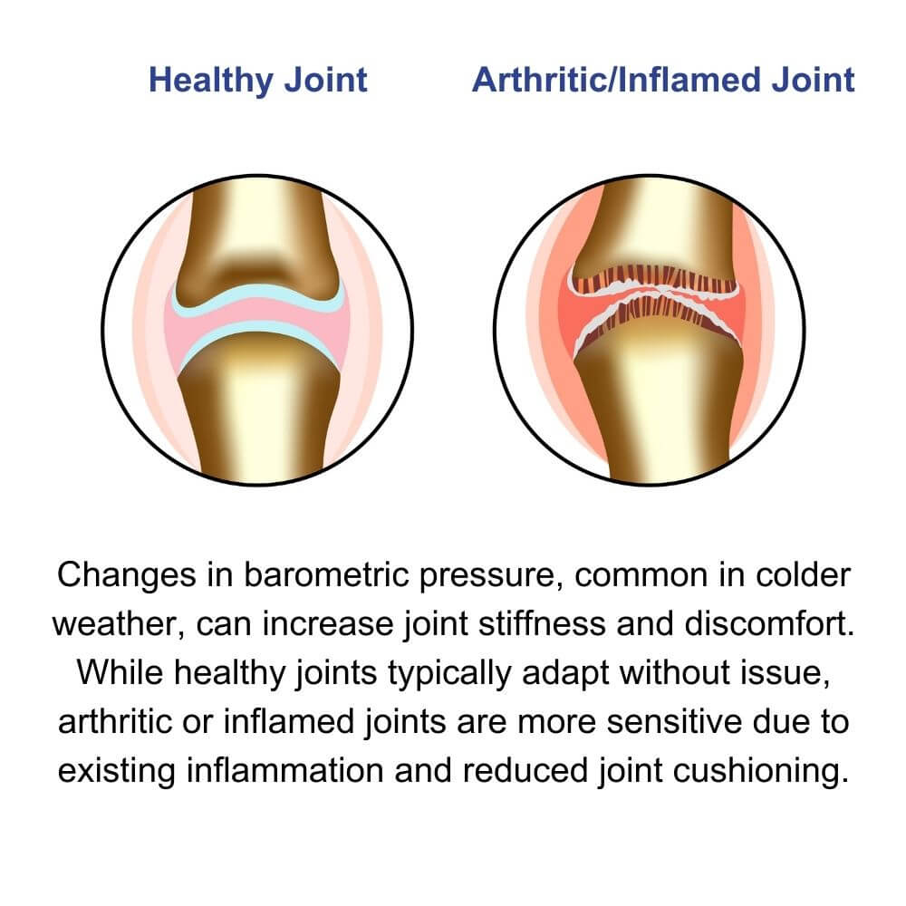 Illustration showing how barometric pressure affects healthy joints vs. arthritic joints