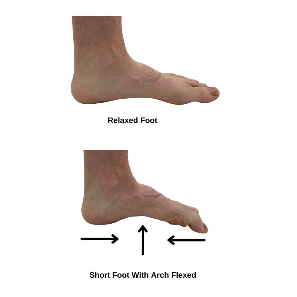 Foot Doming (Arch Lifts)