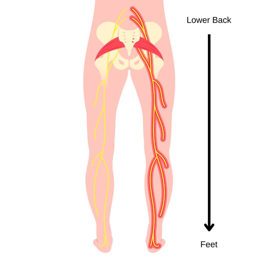 Sciatic Nerve Diagram