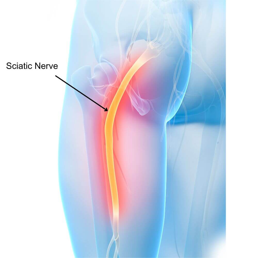 Sciatic Nerve