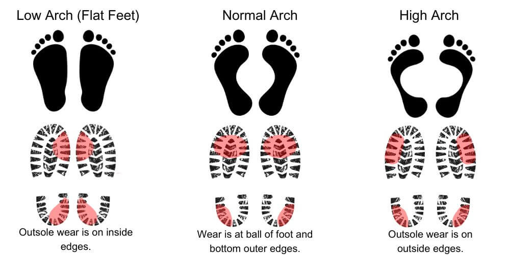 Shoe Wear Patterns Depending on Arch Type