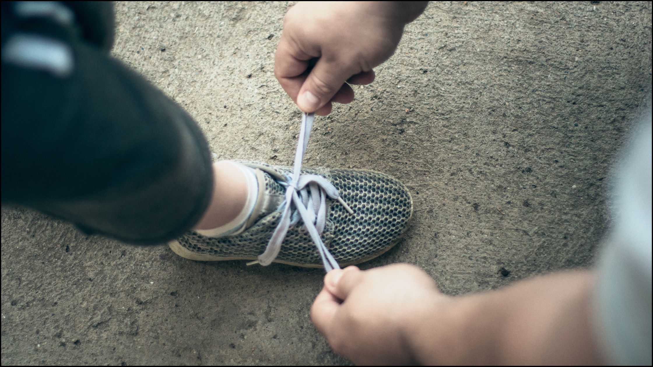 Shoe Lacing Techniques for Swollen Feet